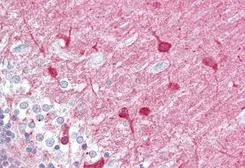 Anti-PACSIN1 antibody used in IHC (Paraffin sections) (IHC-P). GTX22532