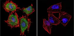 Anti-Cytohesin 1 antibody [2E11] used in Immunocytochemistry/ Immunofluorescence (ICC/IF). GTX22727