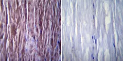 Anti-SERCA1 ATPase antibody [IIH11] used in IHC (Paraffin sections) (IHC-P). GTX22818