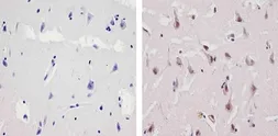 Anti-Ubiquilin 1 antibody used in IHC (Paraffin sections) (IHC-P). GTX23341