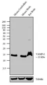 Anti-VAMP2 antibody used in Western Blot (WB). GTX23347