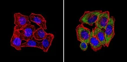 Anti-CPEB1 antibody used in Immunocytochemistry/ Immunofluorescence (ICC/IF). GTX23465