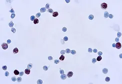 Anti-Adenovirus antibody [M58 + M73] used in Immunocytochemistry/ Immunofluorescence (ICC/IF). GTX23648