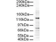 Anti-Ap3D1 antibody used in Western Blot (WB). GTX23705