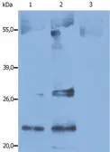 Anti-CD9 antibody [IVA50] used in Western Blot (WB). GTX23923