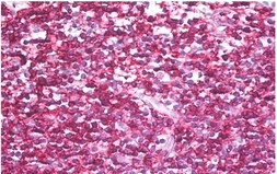 Anti-CD45RB antibody [MEM-143] used in IHC (Paraffin sections) (IHC-P). GTX23979