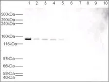 Anti-USP7 antibody used in Western Blot (WB). GTX24080