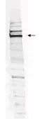 Anti-WHIP antibody used in Western Blot (WB). GTX24731