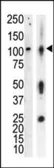 Anti-PKC nu antibody used in Western Blot (WB). GTX25285