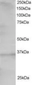 Anti-TCF19 antibody, C-term used in Western Blot (WB). GTX25311
