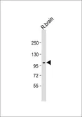 Anti-DDR1 antibody used in Western Blot (WB). GTX25508