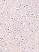 Anti-CIDE A antibody used in IHC (Paraffin sections) (IHC-P). GTX25692