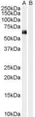 Anti-Syntrophin alpha 1 antibody, N-term used in Western Blot (WB). GTX25941