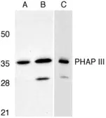 Anti-PHAP3 antibody used in Western Blot (WB). GTX25993