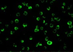 Anti-FLIP antibody used in Immunocytochemistry/ Immunofluorescence (ICC/IF). GTX26144