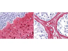 Anti-Collagen III antibody (Biotin) used in IHC (Paraffin sections) (IHC-P). GTX26580