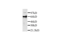 Anti-Perforin antibody used in Western Blot (WB). GTX27203