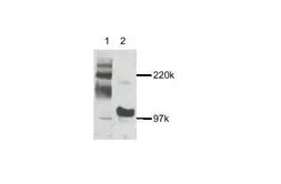 Anti-MAP3K14 antibody used in Western Blot (WB). GTX27204