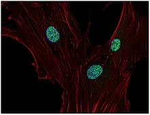 Anti-p21 Cip1 antibody [WA-1] used in Immunocytochemistry/ Immunofluorescence (ICC/IF). GTX27903