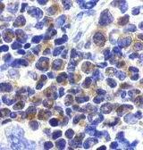 Anti-DAP Kinase 2 antibody used in IHC (Paraffin sections) (IHC-P). GTX28404
