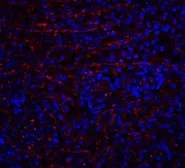 Anti-DR4 antibody used in IHC (Paraffin sections) (IHC-P). GTX28414