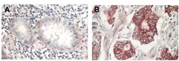 Anti-AKT antibody used in IHC (Paraffin sections) (IHC-P). GTX28805