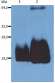 Anti-CD59 antibody [MEM-43/5] used in Western Blot (WB). GTX29183