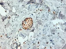 Anti-Estrogen Receptor alpha antibody [6F11] used in IHC (Paraffin sections) (IHC-P). GTX29269