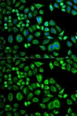 Anti-Apolipoprotein D antibody used in Immunocytochemistry/ Immunofluorescence (ICC/IF). GTX30058