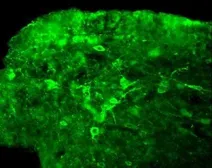 Anti-Neurokinin B antibody used in Immunohistochemistry (IHC). GTX30464