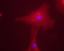 Anti-ChREBP antibody used in Immunocytochemistry/ Immunofluorescence (ICC/IF). GTX30679