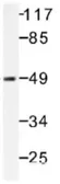 Anti-Tau (phospho Ser235) antibody used in Western Blot (WB). GTX31113