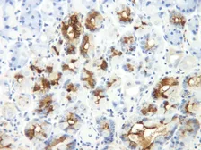 Anti-TFF-2 antibody used in IHC (Paraffin sections) (IHC-P). GTX31203