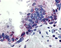 Anti-APRIL antibody used in IHC (Paraffin sections) (IHC-P). GTX31268