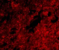 Anti-SLITRK1 antibody used in IHC (Paraffin sections) (IHC-P). GTX31332