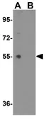 Anti-Glycoprotein VI antibody used in Western Blot (WB). GTX31359