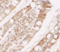 Anti-Lipin 1 antibody used in IHC (Paraffin sections) (IHC-P). GTX31547