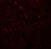Anti-ERAP1 antibody used in IHC (Paraffin sections) (IHC-P). GTX31553