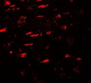 Anti-ULK4 antibody used in IHC (Paraffin sections) (IHC-P). GTX31562