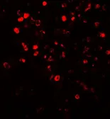 Anti-NOX4 antibody used in IHC (Paraffin sections) (IHC-P). GTX31588