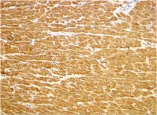Anti-TIRAP antibody used in IHC (Paraffin sections) (IHC-P). GTX31676