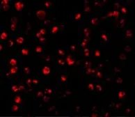 Anti-ATF6 antibody used in Immunocytochemistry/ Immunofluorescence (ICC/IF). GTX31729