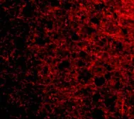 Anti-Stathmin 1 antibody used in IHC (Paraffin sections) (IHC-P). GTX31760
