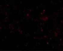 Anti-SR-BI antibody used in IHC (Paraffin sections) (IHC-P). GTX31791
