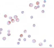 Anti-FOXO4 antibody used in Immunocytochemistry/ Immunofluorescence (ICC/IF). GTX31807