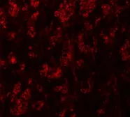 Anti-ATP2C1 antibody used in IHC (Paraffin sections) (IHC-P). GTX31834