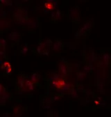 Anti-ROCK1 antibody used in Immunocytochemistry/ Immunofluorescence (ICC/IF). GTX31836