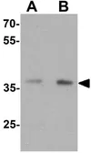 Anti-MECR antibody used in Western Blot (WB). GTX31866