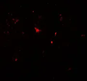 Anti-Parkin antibody used in IHC (Paraffin sections) (IHC-P). GTX31927