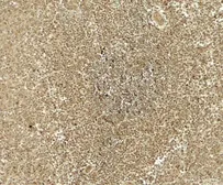 Anti-ATG4B antibody used in IHC (Paraffin sections) (IHC-P). GTX31942